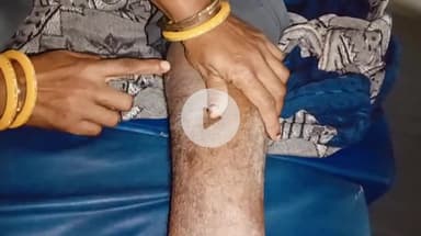 स्लीमनाबाद: खमरिया में खेत में काम करते समय किसान को सांप ने काटा, इलाज जारी