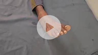 लाडपुरा: बदलते मौसम के चलते एक बुजुर्ग और एक युवक को सांप ने काटा, एमबीएस अस्पताल में भर्ती, उपचार जारी