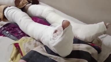 लाडपुरा: नांता थाना इलाके में पुरानी रंजिश के चलते युवक पर तलवार व धारदार हथियारों से किया गया हमला, जिला अस्पताल में इलाज जारी