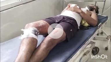 आरा: सकरी बसमनपुर गांव में जमीन विवाद को लेकर चली गोली, छर्रे लगने से छात्र घायल, आरा सदर अस्पताल में कराया गया भर्ती