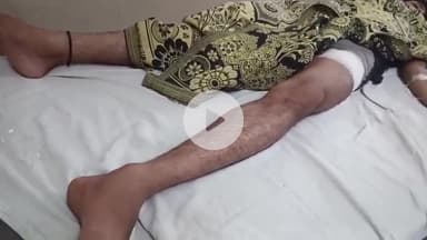 लाडपुरा: कोटा में मोहर्रम देखकर लौट रहे युवक पर बदमाशों ने चाकुओं से किया ताबड़तोड़ हमला, रास्ते में हुई थी कहासुनी