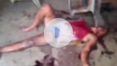 करनैलगंज: भभुआ के बुढवलिया में एक बेटे ने पिता पर चाकू से किया हमला, घायल को गंभीर हालत में जिला अस्पताल रेफर