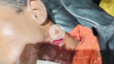 उदवंत नगर: चौकीपुर गांव स्थित बगीचे में दो पक्षों के बीच झगड़ा देखने गए युवक को मारी गोली, पुलिस जांच में जुटी