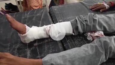 टीकमगढ़: भेलसी गांव के पास तेज रफ़्तार बाइक की टक्कर से घायल हुए पति-पत्नी, जिला अस्पताल में कराया गया भर्ती