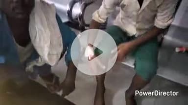 कटिहार: मरंगी नारायणपुर में नाबालिग को जहरीले साँप ने डंसा, अस्पताल में भर्ती