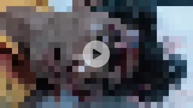 नौगावां सादात: नौगांवा थाने के पास तेज रफ्तार बाइक सवार युवक की बाइक फिसली, युवक हुआ घायल