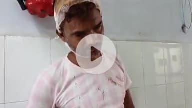 सीतापुर: हाजीपुर ग्राम पंचायत में मामूली बात को लेकर दो पक्षों में जमकर मारपीट, दो लोग हुए घायल