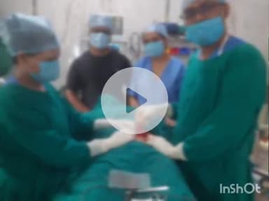 श्योपुर: जिला अस्पताल में पहली बार हुआ इनसिजनल हर्निया का ऑपरेशन, मेडिकल कॉलेज के डॉक्टरों की टीम ने निभाई भूमिका