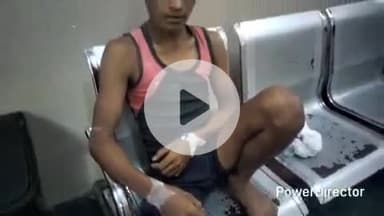 कटिहार: मिरकाहा में भूसा निकालते समय नाबालिग को जहरीले साँप ने डंसा, अस्पताल में भर्ती