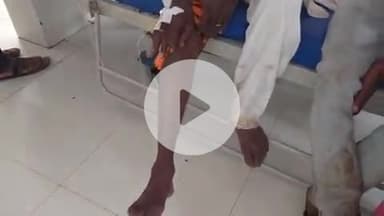 खालवा: मालगांव में खेत पर काम कर रहा किसान सर्पदंश का शिकार हुआ