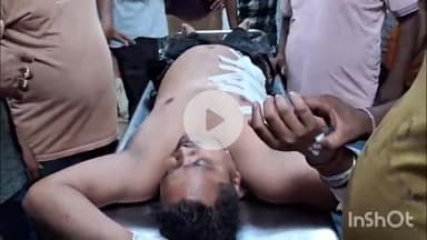 मेदिनीनगर (डालटनगंज): चैनपुर के पास सड़क दुर्घटना में रतनलाल ऑटो बाइक्स शोरूम का कर्मचारी घायल, पेट में घुसा कांच