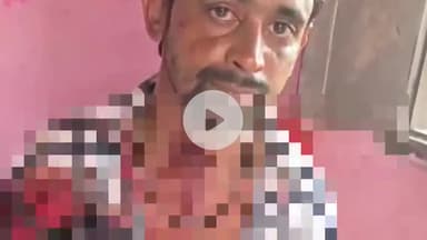 अमरोहा: अमरोहा में दामाद पर कहर, मौहल्ला अफगानान में ससुराल वालों ने बंधक बनाकर जमकर पीटा, बामुश्किल बची जान