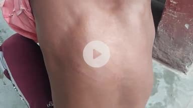 पूरनपुर: सिमरिया सूफी नगर में घर में घुसकर युवक की बेरहमी से पिटाई, रात में साथ जाने से किया था मना