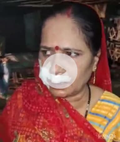 औरैया: खानपुर चौराहे के समीप आवारा घूम रहे युवक ने महिला को काटकर किया गंभीर घायल, कई महिलाओं को बना चुका है अपना शिकार