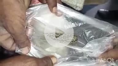 बहराइच: शिवराज टेपरा की महिला को साप ने काटा, बोली- इसी ने मुझे काटा है, इलाज कर दीजिए, सांप लेकर मेडिकल कॉलेज पहुंची