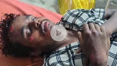 लोहरदगा: बकसीडीपा में तेज रफ्तार बाइक दुर्घटना, दो युवक घायल, एक गंभीर रूप से रिम्स रेफर