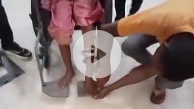 गुमला: बकरी चराने के दौरान बटा लोया गांव में 10 वर्षीय छात्रा को जहरीले सांप ने काटा, अस्पताल में भर्ती