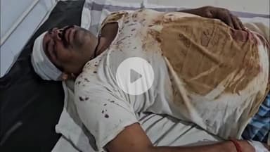 सतना के मरवा गांव में चुनावी रंजिश में जनपद सदस्य पर जानलेवा हमला, अस्पताल में भर्ती, पुलिस जांच जारी