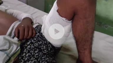 लाडपुरा: झालावाड़ में हाईटेंशन लाइन गिरने से दादा की मौत, पोता समेत तीन झुलसे, युवक का कोटा MBS अस्पताल में इलाज जारी