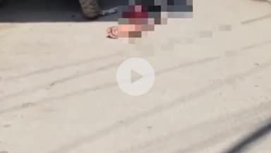 आरा: महावीर टोला में इंसान के कटे पैर को खाते हुए कुत्ते का वीडियो आया सामने, पुलिस के जाने से पहले पैर हुआ गायब