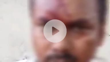 सहजनवा: भीटी रावत गाँव में पेड़ की डाल काटने को लेकर दो भाइयों में विवाद, बड़े भाई ने छोटे भाई पर ईंट से किया हमला