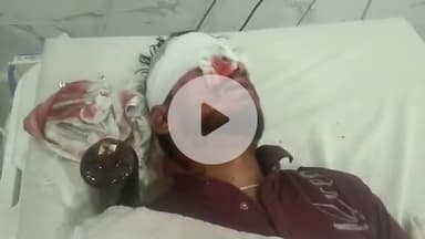 बनेड़ा: बामनिया चौराहे के समीप बाइक अनियंत्रित होकर डिवाइडर से टकराई, युवक घायल, जिला चिकित्सालय से हायर सेंटर रेफर