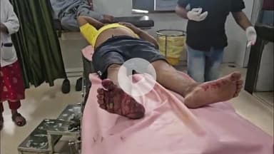 सुनौरा के पास दो बाइकों की भिड़ंत में तीन घायल, सतना जिला अस्पताल में भर्ती, पुलिस जांच जारी