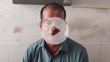 घाटमपुर: फैजुल्लापुर में जमीन की पैमाइश के दौरान दबंगों ने लेखपाल को पीटा, 2 घंटे इलाज के लिए CHC में डॉक्टर का करता रहा इंतजार