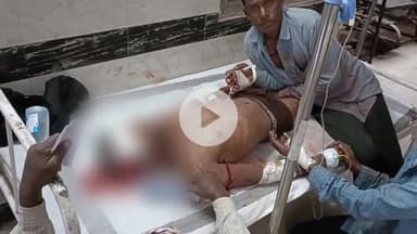 ग्राम रिगरा के पास NH-30 पर आवारा पशु से टकराकर घायल हुए बाइक सवार 3 लोग, एक को CHC से ज़िला अस्पताल किया गया रेफर