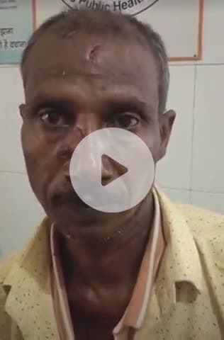 नवाबगंज: रेंदुआ पल्हरी गांव में रिश्तों की सारी हदें पार, नशे में धुत बेटे ने पिता पर किया ईंट से हमला