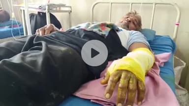 बड़गांव: सांप के काटने पर थैली में सांप लेकर MB हॉस्पिटल पहुंचे जमील, सूझबूझ व हॉस्पिटल स्टाफ की तत्परता से बची जान