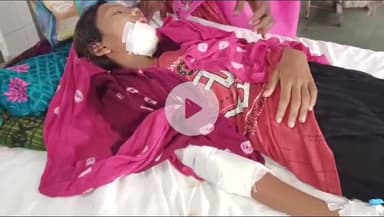 बांसवाड़ा: उटिया पाण गांव में घर से स्कूल जा रही छात्रा को बाइक ने मारी टक्कर, एमजी अस्पताल में उपचार जारी