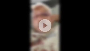 बड़ौत: निरपुड़ा में पालतू कुत्ते के गंदगी करने से रोकने पर कुत्ते के मालिक ने बुजुर्ग को किया घायल, अस्पताल में भर्ती