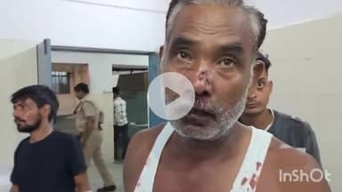 बरेली: प्रेम नगर थाना क्षेत्र हार्टमैंन रामलीला गोटिया में कलयुगी बेटे ने नशे में पिता के साथ की मारपीट, पिता हुआ लहूलुहान