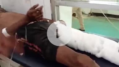 सीतापुर: गोला रोड पर तेज रफ्तार अज्ञात वाहन ने बुजुर्ग को मारी जोरदार टक्कर, बुजुर्ग घायल, अस्पताल में इलाज जारी