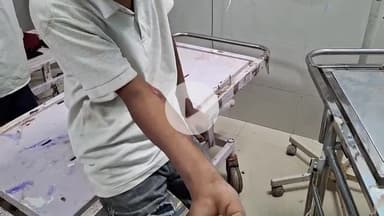 उदवंत नगर: सलथर और मल्थर गांव के समीप उत्तरप्रदेश निवासी युवक सड़क हादसे में हुआ जख्मी