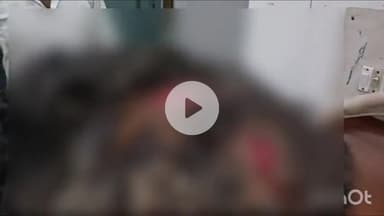 कोल: दुबे का पड़ाव में B.Com के छात्र को दोस्त से पैसे वापस मांगना पड़ा भारी, दोस्त ने साथियों के साथ मिलकर की मारपीट