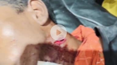 उदवंत नगर: चौकीपुर में हुए गोली कांड के आरोपियों की गिरफ्तारी के लिए पुलिस द्वारा छापेमारी की जा रही है