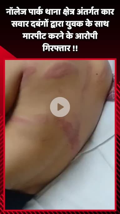 दादरी: नॉलेज पार्क थाना क्षेत्र में कार सवार दबंगों द्वारा युवक के साथ मारपीट करने के आरोपियों को किया गया गिरफ्तार