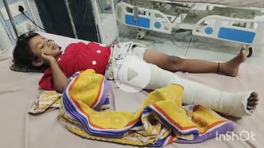 भीलवाड़ा: बडला चौराहे पर अचानक आए पशु को बचाने के प्रयास में बाइक अनियंत्रित होकर फिसली, बाइक सवार पिता-पुत्री गंभीर घायल