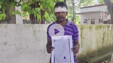 कोल: शमशाद मार्केट में आपसी विवाद में दबंगों ने एक व्यक्ति के सिर पर डंडा मारकर फोड़ा, एसएसपी से की शिकायत