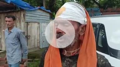 घोसी: घनहारा पर गांव में जमीनी विवाद को लेकर मारपीट, घायल पहुंचा घोसी थाने