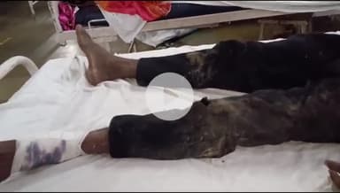 बांसवाड़ा: सदर थाना क्षेत्र के गणाऊ गांव में दो बाइक की आमने-सामने भिड़ंत में युवक को लगी चोट, एमजी अस्पताल में उपचार जारी