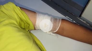 उदवंत नगर: डेमहां गांव के समीप हथियारबंद बदमाशों ने कोर्ट कर्मचारी के पुत्र को प्रेम प्रसंग में मारी गोली, 4 साल से चल रहा था प्रेम