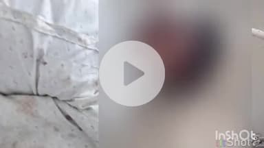 ब्यौहारी: पपौंध के कुआं गांव में ऑटो से गिरा शख्स गंभीर रूप से घायल, पुलिस ने अस्पताल पहुंचाया