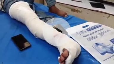 लाडपुरा: MBS अस्पताल से ड्यूटी कर घर जा रहे डॉक्टर 2 स्कूटी की भिड़ंत में घायल, एमबीएस अस्पताल में भर्ती, उपचार जारी