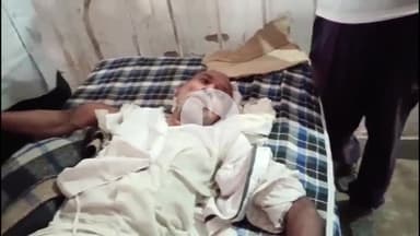 चंदला: चंदला में बाइक सवारों ने 65 वर्षीय वृद्ध को बेरहमी से पीटा, हाथ तोड़ा