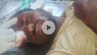 उदवंत नगर: तेतरिया मोड के समीप दो बाइक की आमने-सामने टक्कर में चार लोग बुरी तरह जख्मी, एक जख्मी को पटना रेफर किया गया