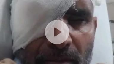 सहजनवा: हरपुर बुदहट में इनवर्टर की बैटरी फटने से दुकानदार की आंख की रोशनी गई, बैटरी लेकर आए शख्स के खिलाफ पुलिस से की गई शिकायत