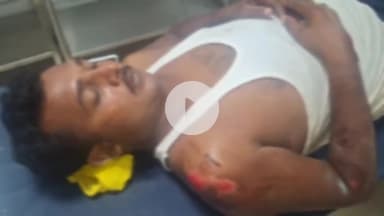 उदवंत नगर: बेलाउर बंगला के समीप अज्ञात वाहन को चकमा देने के दौरान बाइक सवार युवक अनियंत्रित होकर पलटा, जख्मी